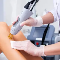 Laser Hair Removal Treatment by Beauty Refined in Parker, CO