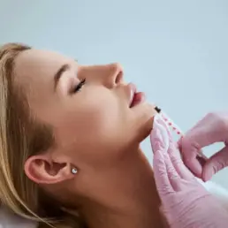 Lip Filler by Beauty Refined
