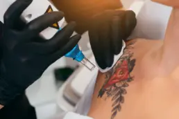 women taking Laser Tattoo Removal in Greenwood Village, CO