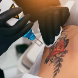 women taking Laser Tattoo Removal in Greenwood Village, CO